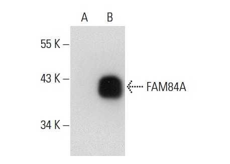 FAM84A (BA-9): sc-101207. Western blot analysis of FAM84A expression in non-transfected: sc-117752 (A) and human FAM84A transfected: sc-175348 (B) 293T whole cell lysates.