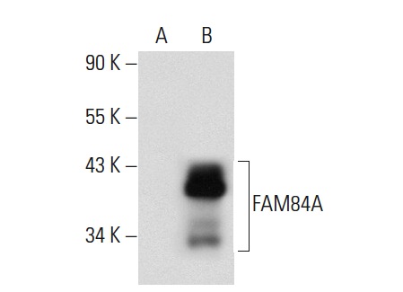 FAM84A (BA-9): sc-101207. Western blot analysis of FAM84A expression in non-transfected: sc-117752 (A) and human FAM84A transfected: sc-175345 (B) 293T whole cell lysates.