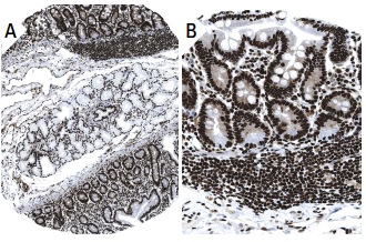 Pol II (CTD4H8): sc-47701. Immunoperoxidase staining of formalin fixed, paraffin-embedded human duodenum tissue showing nuclear staining of glandular cells (low and high magnification). Kindly provided by The Swedish Human Protein Atlas (HPA) program.