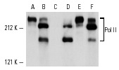 p-Pol II (8A7): sc-13583. Western blot analysis of Pol II phosphorylation in untreated (A), heat shocked (C) and calyculin-treated (E) HeLa cultures. Total Pol II levels were determined in the same respective extracts by using Pol II (A-10): sc-17798 (B,D,F).