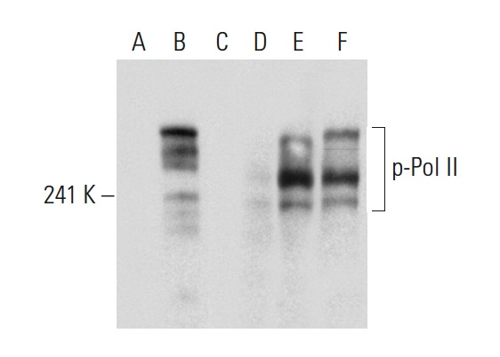 Western blot analysis of Pol II phosphorylation in untreated (A,D), calyculin A treated (B,E) and calyculin A and lambda protein phosphatase (sc-200312A) treated (C,F) HeLa whole cell lysates. Antibodies tested include p-Pol II (8A7): sc-13583 (A,B,C) and Pol II (8WG16): sc-56767 (D,E,F).