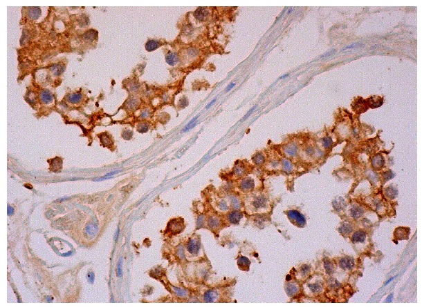 RNF8 (B-2): sc-271462. Immunoperoxidase staining of formalin fixed, paraffin-embedded human testis tissue showing cytoplasmic and membrane staining of cells in seminiferous ducts.