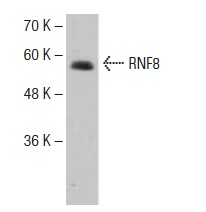 RNF8 (X-21): sc-133971. Western blot analysis of RNF8 expression in Jurkat whole cell lysate.