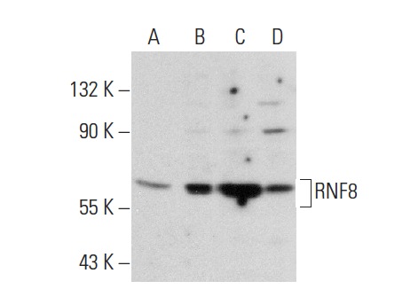 RNF8 (X-21): sc-133971. Western blot analysis of RNF8 expression in non-transfected: sc-117752 (A) and mouse RNF8 transfected: sc-123246 (B) 293T whole cell lysates and Jurkat (C) and THP-1 (D) nuclear extracts.