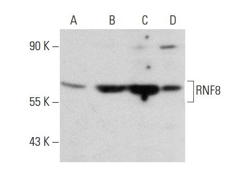 RNF8 (X-21): sc-133971. Western blot analysis of RNF8 expression in non-transfected: sc-117752 (A) and human RNF8 transfected: sc-174061 (B) 293T whole cell lysates and Jurkat (C) and THP-1 (D) nuclear extracts.