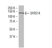 SFRS14 (S-24): sc-101131. Western blot analysis of SFRS14 expression in HeLa nuclear extract.