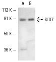 SLU7 (N-18): sc-10828. Western blot analysis of SLU7 expression in HeLa (A) and K-562 (B) nuclear extracts.