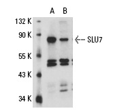SLU7 (L-16): sc-10829. Western blot analysis of SLU7 expression in non-transfected: sc-110760 (A) and human SLU7 transfected: sc-111150 (B) 293 whole cell lysates.