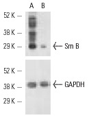 Sm B siRNA (h): sc-36503. Western blot analysis of Sm B expression in non-transfected control (A) and Sm B siRNA transfected (B) HeLa cells. Blot probed with Sm B/B'/N (FL-240): sc-25372. GAPDH (FL-335): sc-25778 used as specificity and loading control.