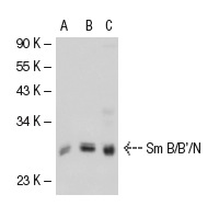Sm B/B'/N (FL-240): sc-25372. Western blot analysis of Sm B/B'/N expression in non-transfected: sc-117752 (A) and human Sm B/B'/N transfected: sc-114542 (B) 293T whole cell lysates and HeLa nuclear extract (C).