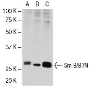 Sm B/B'/N (FL-240): sc-25372. Western blot analysis of Sm B/B'/N expression in HeLa (A), KNRK (B) and K-562 (C) nuclear extracts.