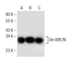 Sm B/B'/N (FL-240): sc-25372. Western blot analysis of Sm B/B'/N expression in K-562 (A), HeLa (B) and KNRK (C) nuclear extracts.