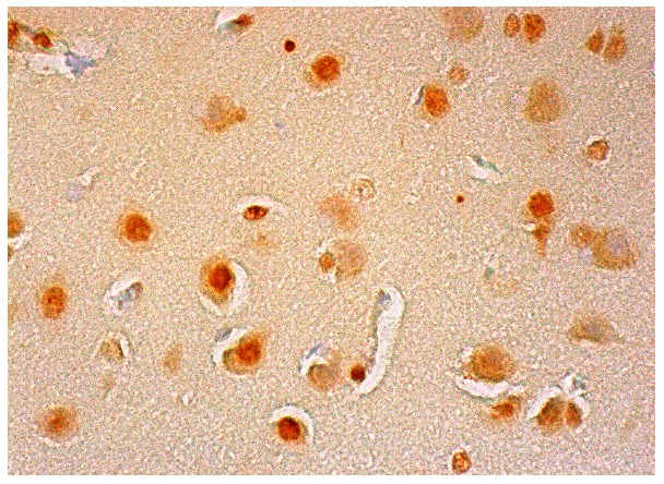 Sm B/B'/N (FL-240): sc-25372. Immunoperoxidase staining of formalin fixed, paraffin-embedded human cerebral cortex tissue showing nuclear staining of neuronal cells, glial cells and Endothelial cells.