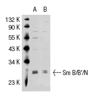 Sm B/B'/N (N-18): sc-5485. Western blot analysis of Sm B/B'/N expression in non-transfected: sc-117752 (A) and human Sm B/B'/N transfected: sc-114542 (B) 293T whole cell lysates.