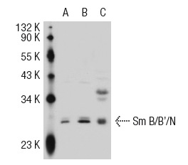 Sm B/B'/N (N-18): sc-5485. Western blot analysis of Sm B/B/N expression in non-transfected: sc-117752 (A) and human Sm B/B/N transfected: sc-114542 (B) 293T whole cell lysates and HeLa nuclear extract (C).