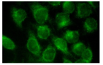 Sm B/B/N (N-18): sc-5485. Immunofluorescence staining of methanol-fixed HeLa cells showing cytoplasmic and nuclear localization.