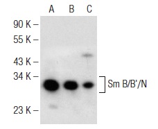 Sm B/B'/N (N-18): sc-5485. Western blot analysis of Sm B/B'/N expression in K-562 (A), HeLa (B) and KNRK (C) nuclear extracts.