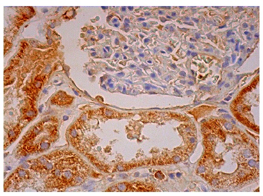 Smad (C-17): sc-6030. Immunoperoxidase staining of formalin fixed, paraffin-embedded human kidney tissue showing cytoplasmic staining of cells in glomeruli and cells in tubules.