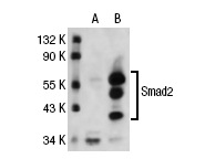 Smad2/3 (E-20): sc-6033. Western blot analysis of Smad2 expression in non-transfected: sc-117752 (A) and human Smad2 transfected: sc-113452 (B) 293T whole cell lysates.