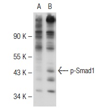 p-Smad1/5/8 (Ser 463/Ser 465)-R: sc-12353-R. Western blot analysis of Smad1 phosphorylation in non-transfected: sc-117752 (A) and human Smad1 transfected: sc-171449 (B) 293T whole cell lysates.
