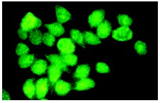 SMC1 (P-17): sc-21078. Immunofluorescence staining of methanol-fixed HeLa cells showing nuclear localization.