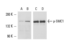 Western blot analysis of SMC1 expression in lambda protein phosphatase treated (A,C) or untreated (B,D) HeLa nuclear extract. Antibodies tested include p-SMC1 (5911G5): sc-56746 (A,B) and SMC1 (P-17): sc-21078 (C,D).