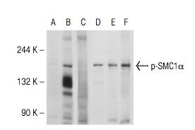 Western blot analysis of SMC1α phosphorylation in untreated (A,D), UV irradiated (B,E) and UV irradiated and lambda protein phosphatase treated (C,F) HeLa whole cell lysates. Antibodies tested include p-SMC1α (43.Ser 966): sc-135784 (A,B,C) and SMC1α (M-16): sc-30958 (D,E,F).