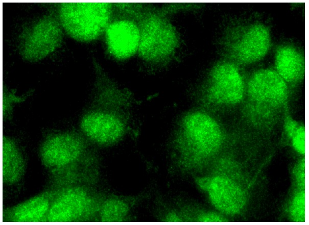 SNRPC (H-70): sc-292035. Immunofluorescence stain-ing of formalin-fixed HepG2 cells showing nuclear localization.