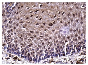 Sox-2 (Y-17): sc-17320. Immunoperoxidase staining of formalin fixed, paraffin-embedded human cervix tissue showing nuclear and cytoplasmic staining of squamous epithelial cells.