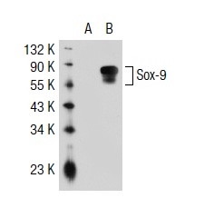 Sox-9 (C-20): sc-17341. Western blot analysis of Sox-9 expression in non-transfected: sc-117752 (A) and human Sox-9 transfected: sc-116634 (B) 293T whole cell lysates.