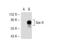 Sox-9 (C-20): sc-17341. Western blot analysis of Sox-9 expression in non-transfected: sc-117752 (A) and mouse Sox-9 transfected: sc-126032 (B) 293T whole cell lysates.