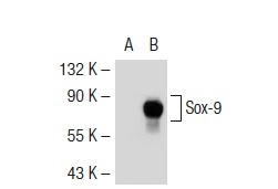 Sox-9 (C-20): sc-17341. Western blot analysis of Sox-9 expression in non-transfected: sc-117752 (A) and mouse Sox-9 transfected: sc-126033 (B) 293T whole cell lysates.