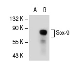 Sox-9 (P-20): sc-17340. Western blot analysis of Sox-9 expression in non-transfected: sc-117752 (A) and mouse Sox-9 transfected: sc-126032 (B) 293T whole cell lysates.