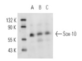 Sox-10 (N-20): sc-17342. Western blot analysis of Sox-10 expression in mouse brain (A), rat cerebellum (B) and rat brain (C) tissue extracts.