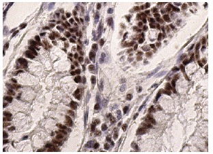 Sp1 (H-225): sc-14027. Immunoperoxidase staining of formalin fixed, paraffin-embedded human colon tissue showing nuclear staining of glandular cells.