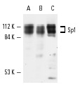 Sp1 (PEP 2): sc-59. Western blot analysis of Sp1 expression in HeLa (A), K-562 (B) and A-431 (C) whole cell lysates.