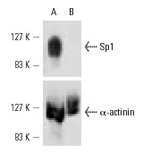 Sp1 siRNA (h): sc-29487. Western blot analysis of Sp1 expression in non-transfected control (A) and Sp1 siRNA transfected (B) A-431 cells. Blot probed with Sp1 (PEP 2): sc-59. α-actinin (H-2): sc-17829 used as specificity and loading control.