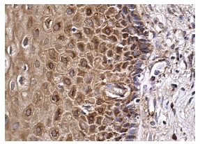 FLIP<sub>S/L</sub> (H-202): sc-8347. Immunoperoxidase staining of formalin fixed, paraffin-embedded human cervix tissue showing cytoplasmic staining of squamous epithelial cells.