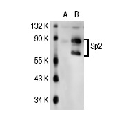 Sp2 (K-20): sc-643. Western blot analysis of Sp2 expression in non-transfected: sc-117752 (A) and human Sp2 transfected: sc-113315 (B) 293T whole cell lysates.