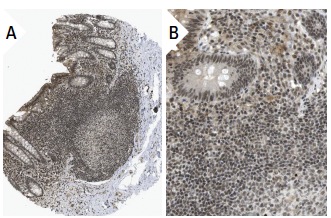 Sp2 (K-20): sc-643. Immunoperoxidase staining of formalin fixed, paraffin-embedded human appendix tissue showing nuclear staining of glandular and lymphoid cells at low (A) and high (B) magnification. Kindly provided by The Swedish Human Protein Atlas (HPA) program.
