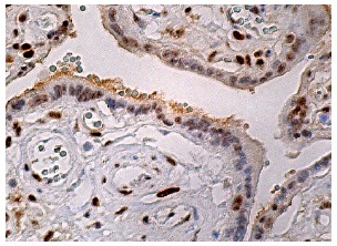 Sp3 (G-7): sc-365220. Immunoperoxidase staining of formalin fixed, paraffin-embedded human placenta tissue showing nuclear staining of trophoblastic cells.