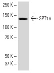 SPT16 (H-300): sc-28734. Western blot analysis of SPT16 expression in UV-treated HeLa whole cell lysate.
