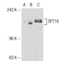 SPT16 (H-300): sc-28734. Western blot analysis of SPT16 expression in non-transfected: sc-117752 (A) and mouse SPT16 transfected: sc-123762 (B) 293T whole cell lysates and HeLa nuclear extract (C).