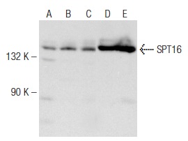 SPT16 (H-300): sc-28734. Western blot analysis of SPT16 expression in HeLa (A), A549 (B), SH-SY5Y (C), K-562 (D) and Jurkat (E) nuclear extracts.