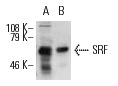 SRF (H-300): sc-13029. Western blot analysis of SRF expression in Jurkat whole cell lysate (A) and Jurkat whole cell lysate immunoprecipitated with SRF (A-11): sc-25290 and detected with SRF (H-300): sc-13029 (B).