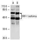 SRF (A-11): sc-25290. Western blot analysis of SRF-1 isoform expression in MCF7 (A) and HUV-EC (B) whole cell lysates.