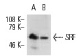SRF (G-20): sc-335. Western blot analysis of SRF expression in Jurkat whole cell lysate (A) and Jurkat whole cell lysate immunoprecipitated with SRF (A-11): sc-25290 and detected with SRF (G-20): sc-335 (B).