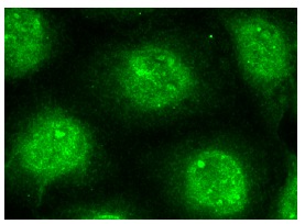 SRF (G-20): sc-335. Immunofluorescence staining of methanol-fixed HeLa cells showing nuclear localization.