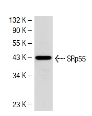 SRp55 (D-14): sc-34197. Western blot analysis of SRp55 expression in human PBL whole cell lysate.