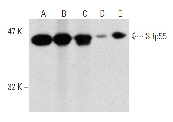 SRp55 (D-14): sc-34197. Western blot analysis of SRp55 expression in human PBL (A), rat PBL (B) and mouse PBL (C) whole cell lysates and HeLa (D) and CCRF-CEM (E) nuclear extracts.